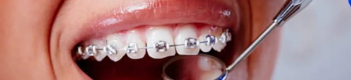 افضل دكتور تقويم اسنان بالمدينه المنوره 