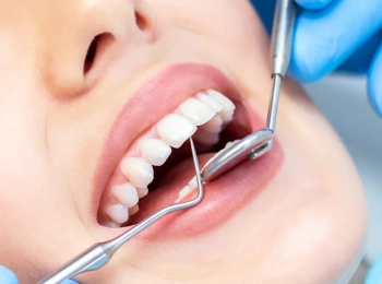 أفضل طريقة لتجميل الأسنان في مجمع الطب المتميز بالمدينة المنورة