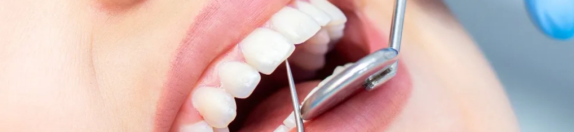 أفضل طريقة لتجميل الأسنان في مجمع الطب المتميز بالمدينة المنورة