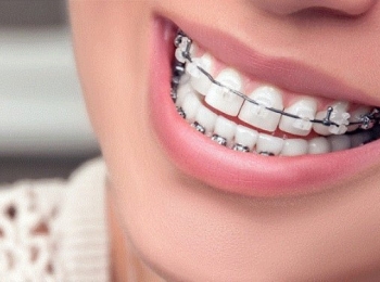 افضل دكتور تقويم اسنان في المدينه المنوره