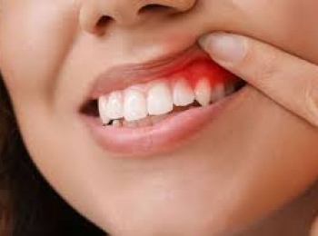 اسباب التهابات الاسنان وطرق علاجها