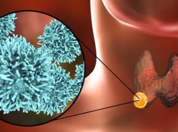 تعرف على اهم اعراض الغدد الصماء عند الكبار