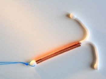 متى يتوقف الدم بعد تركيب اللولب النحاسي؟