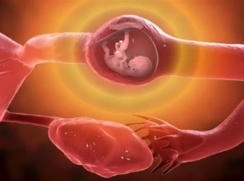 افضل دكتور اشعه الحمل خارج الرحم في مجمع الطب المتميز