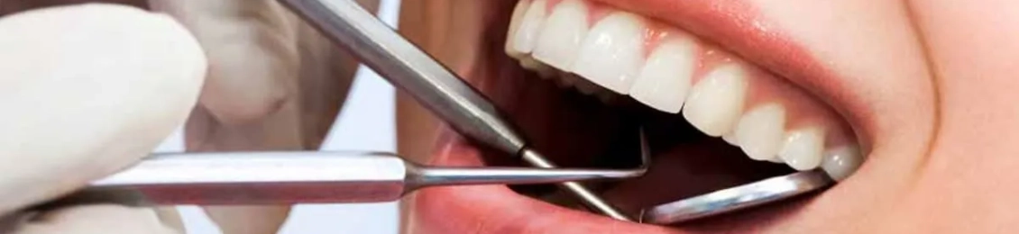 تعديل الأسنان بدون تقويم في المدينة المنورة