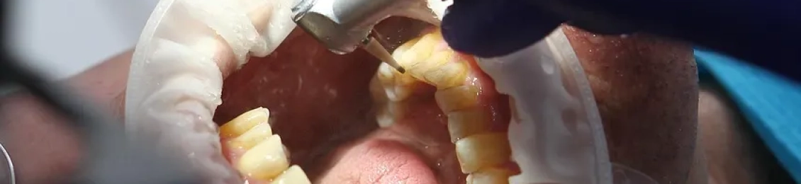 اهم خدمات عيادة تجميل اسنان في المدينة المنورة