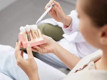 اهم الممنوعات بعد زراعة الأسنان مع افضل الاطباء