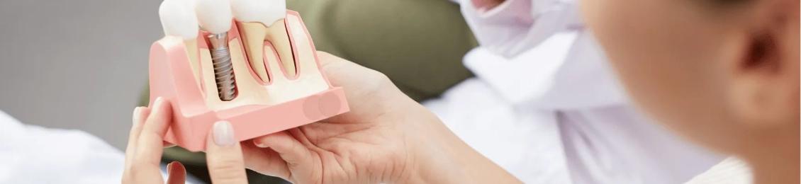 اهم الممنوعات بعد زراعة الأسنان مع افضل الاطباء