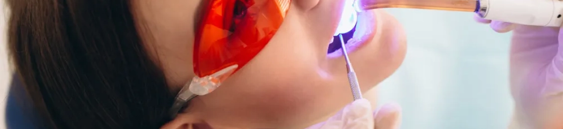 ما هي شروط زراعة الاسنان وكم مدة شفاء زراعة الأسنان؟