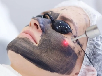 ما هي فوائد الليزر للوجه للبقع الداكنة