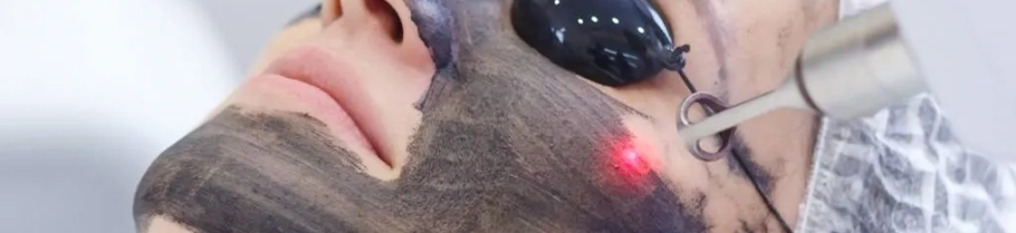 ما هي فوائد الليزر للوجه للبقع الداكنة