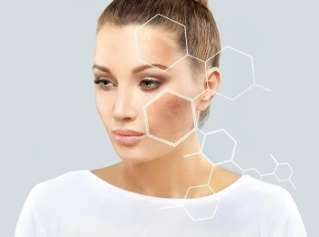 كيفية ازالة التصبغات بالليزر وكم جلسة تحتاج ؟