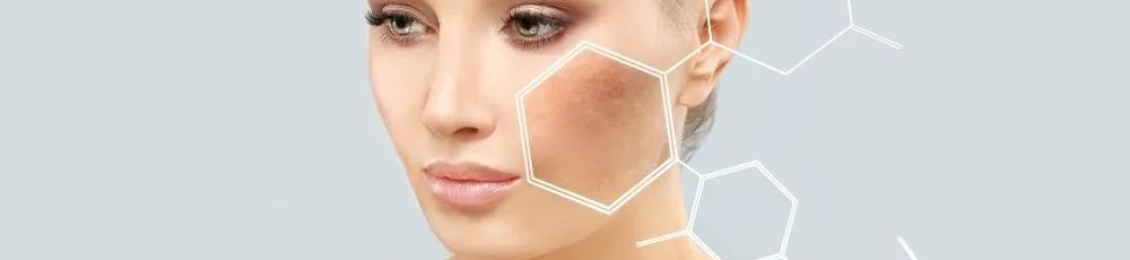 كيفية ازالة التصبغات بالليزر وكم جلسة تحتاج ؟