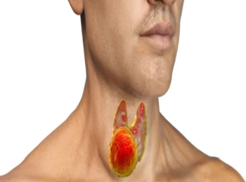 ما هي أعراض الغدد الصماء عند الرجال؟