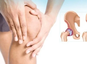 سبب آلام المفاصل الرجلين الشائع وطرق تخفيف الألم