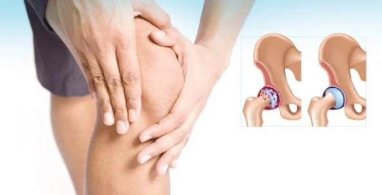 سبب آلام المفاصل الرجلين الشائع وطرق تخفيف الألم