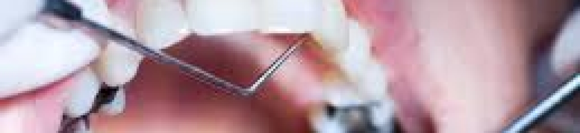 كيف أحافظ على حشوات الأسنان الأمامية؟ نصائح يومية مهمة