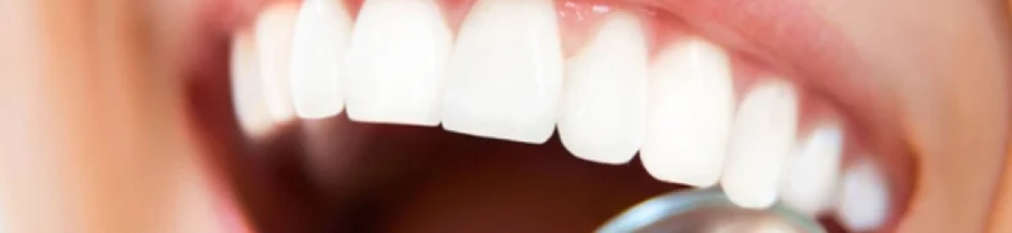 كيف أحسن شكل أسناني؟ مع أفضل أطباء المدينة المنورة