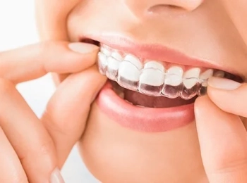 د. ابراهيم زيتوني افضل دكتور تقويم أسنان شفاف 