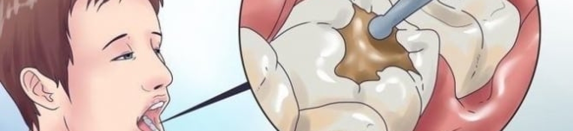 علاج ألم الضرس بعد الحشو الدائم مع أفضل الاطباء