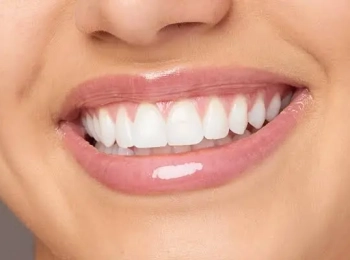 حجز ابتسامة هوليود بالمدينة المنورة بأفضل العروض