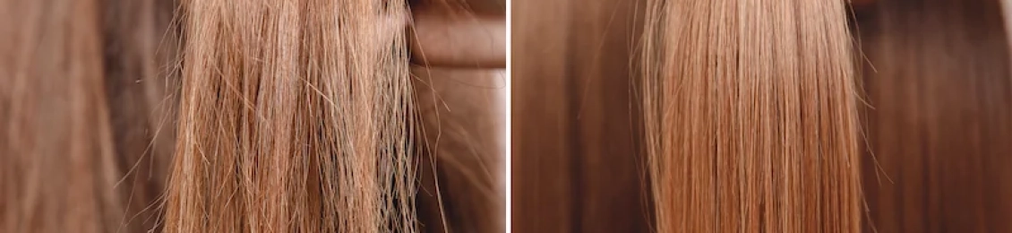 كيفية استعمال botox للشعر في عيادات المدينة المنورة