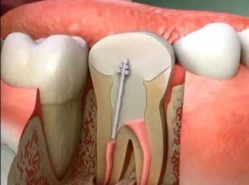 افضل اخصائي اعصاب اسنان في المدينة المنورة