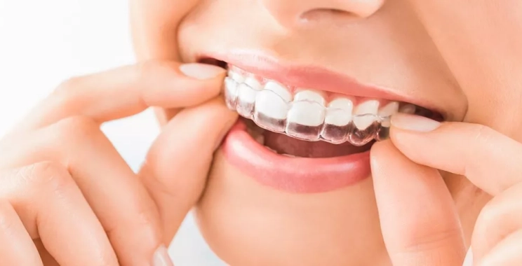 اهتزاز الأسنان أثناء التقويم: الأسباب الحقيقية وكيفية التعامل معها