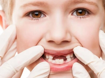 أسنان الأطفال والعناية بها مع أطباء مجمع الطب المتميز 