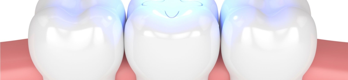 تعرف على مميزات الحشو الابيض بالليزر