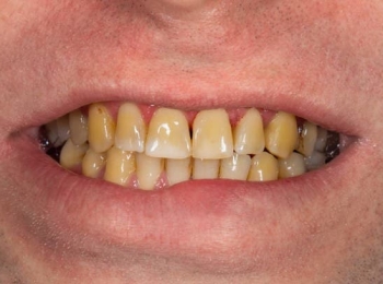 أسباب اصفرار الاسنان وعلاجه في مجمع الطب المتميز