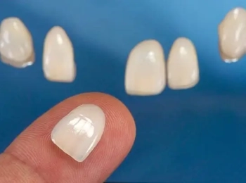 هل الفينير يسبب رائحه كريهه؟