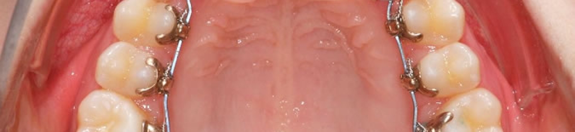 تعرف على شكل الأسنان التي تحتاج إلى تقويم في مجمع الطب المتميز بالمدينة المنورة