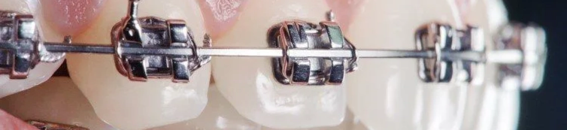 علاج اسنان متراكمه بسهولة مع مجمع الطب المتميز بالمدينة المنورة