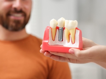 زراعة الاسنان لمريض السكر مع د.محمد بشار