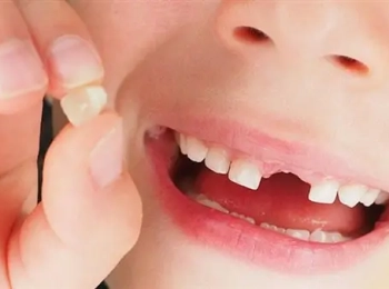 طرق وقاية اسنان الاطفال اللبنية مع د.رامي نفاخ