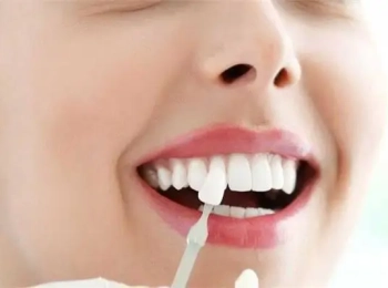 تركيبات الايماكس انواعها ومميزاتها