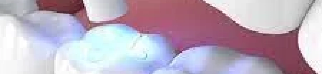 حشو البلاتين الأبيض: الفرق بينه وبين الأنواع الأخرى ومتى يُستخدم؟