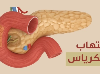 ما هو التهاب البنكرياس المزمن وكيفية علاجه؟