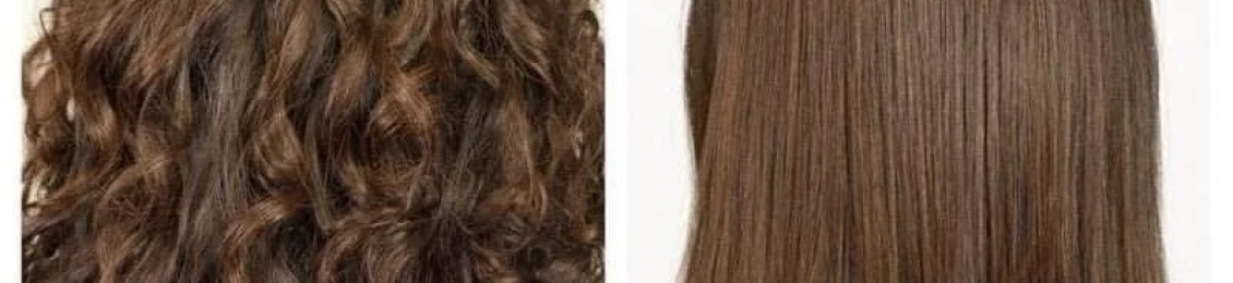 د.زينب جلال أفضل دكتورة أنواع البوتكس للشعر