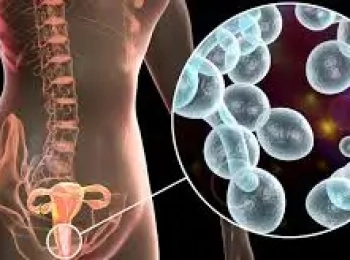 افضل دكتورة اشعة لتحديد علاج التهاب البول والمهبل