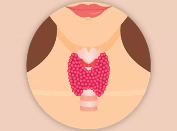 اسباب التسمم الدرقي وأهم الأعراض والعلامات وكيفية التعامل معه وعلاجه