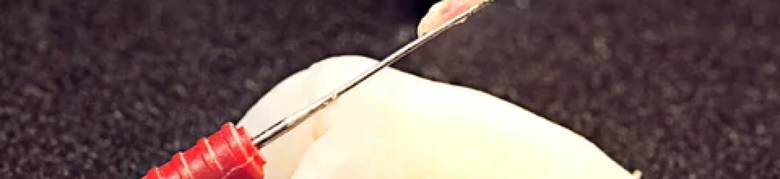 اهم اعراض التهاب عصب السن وكيفية علاجه