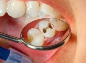 علاج أعراض التهاب عصب الضرس العلوي مع دكتور طارق ابو حماد