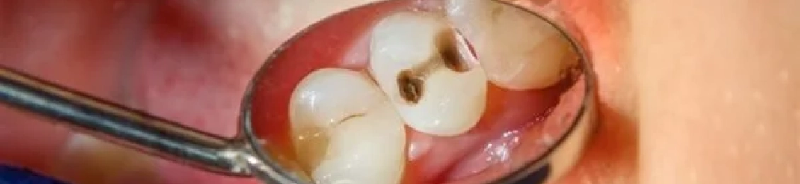 علاج أعراض التهاب عصب الضرس العلوي مع دكتور طارق ابو حماد