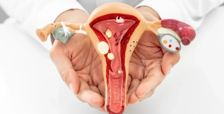 أعراض التهاب المبايض للعذراء وأسبابها الشائعة