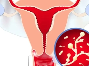 هل الالتهابات تمنع الحمل وكيفية العلاج والوقاية؟