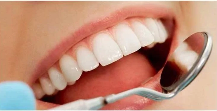 سعر الحشو التجميلي للأسنان الأمامية في المدينة المنورة