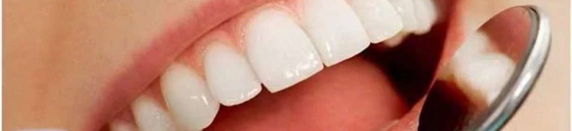 سعر الحشو التجميلي للأسنان الأمامية في المدينة المنورة