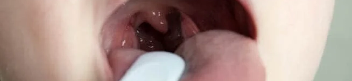 التهاب الحلق لا يستجيب للمضاد؟ الأسباب والعلاج المناسب